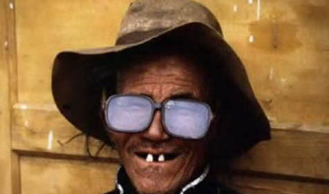 Big-Glasses-Ugly-Man-With-Bad-Teeth.jpg